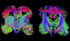 Imagen de la formación de conexiones entre regiones del cerebro. Imagen del Instituto Allen para Ciencias del Cerebro.